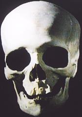 Skull